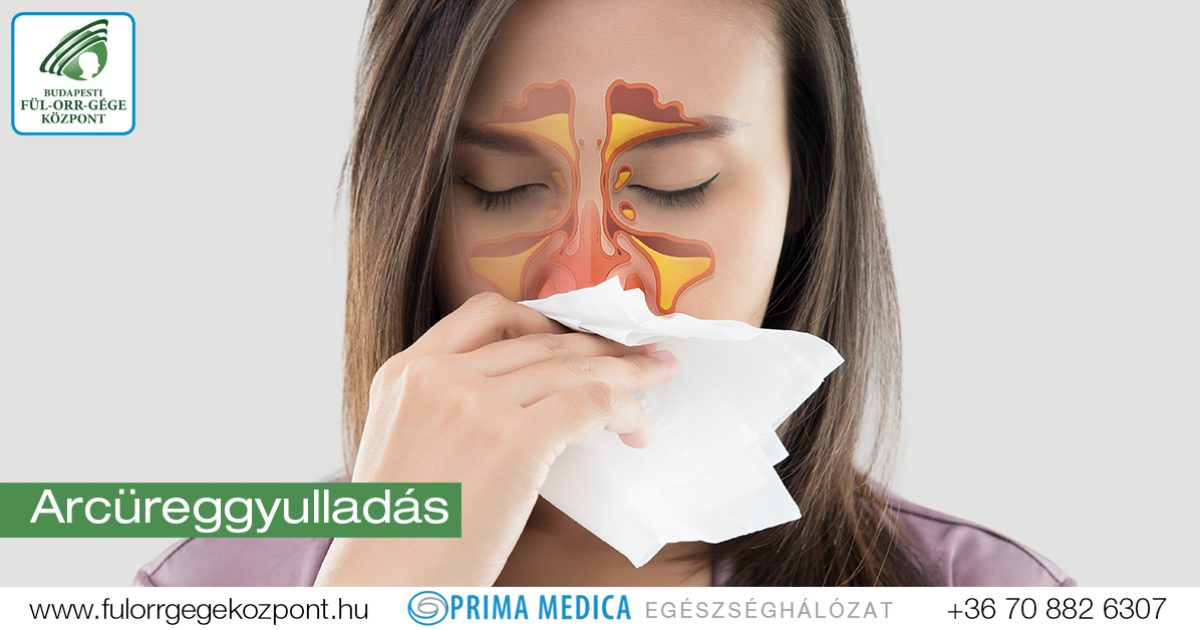 sinusitis antibiotikum kezelés