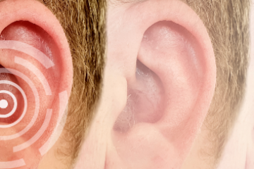 A hallásvesztés típusai