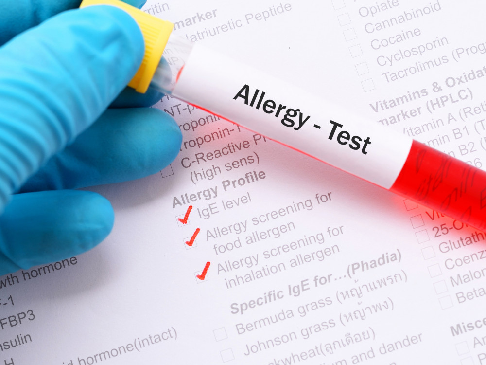 allergia vizsgálat